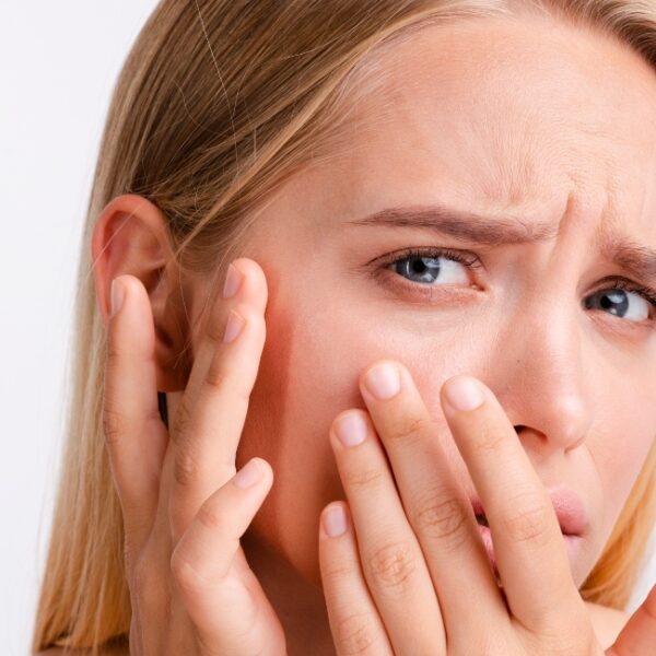 Fair Skin Rosacea Swedish Model